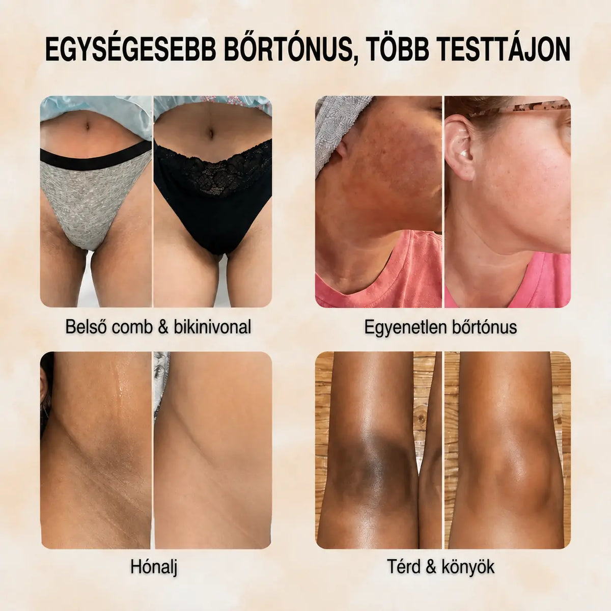 Kurkuma & Kojic Sav – Bőrtónus-kiegyenlítő Szappan
